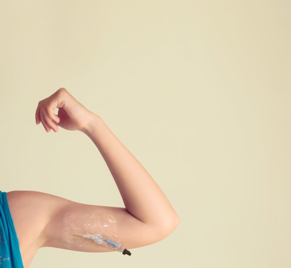 Woman's arm isolated. people, healthcare and medicine concept